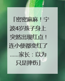 密密麻麻！宁波4岁孩子身上突然出现红点！连小便都变红了……家长：以为只是摔伤